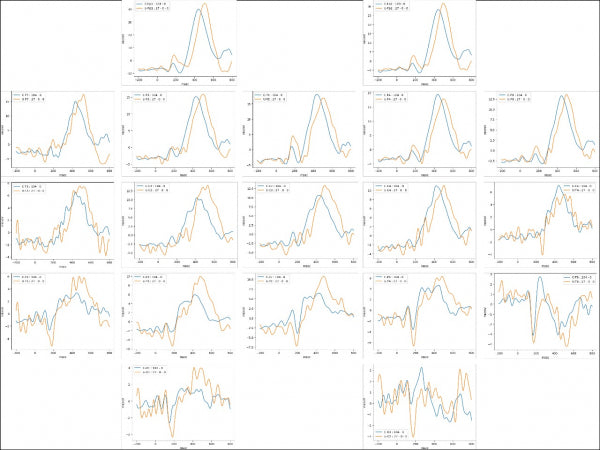 IFEN ERP-Set: Ereignis-Korrelierte Potentiale für Brainmaster Atlantis und Discovery