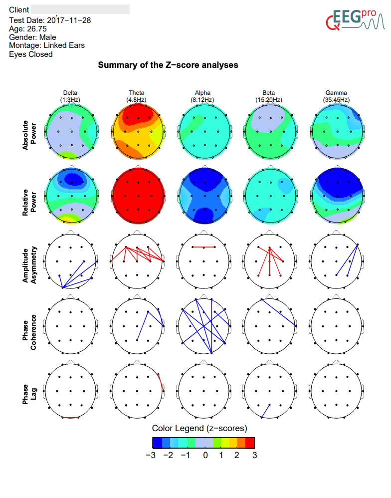 qEEG-Report-Service Bronze