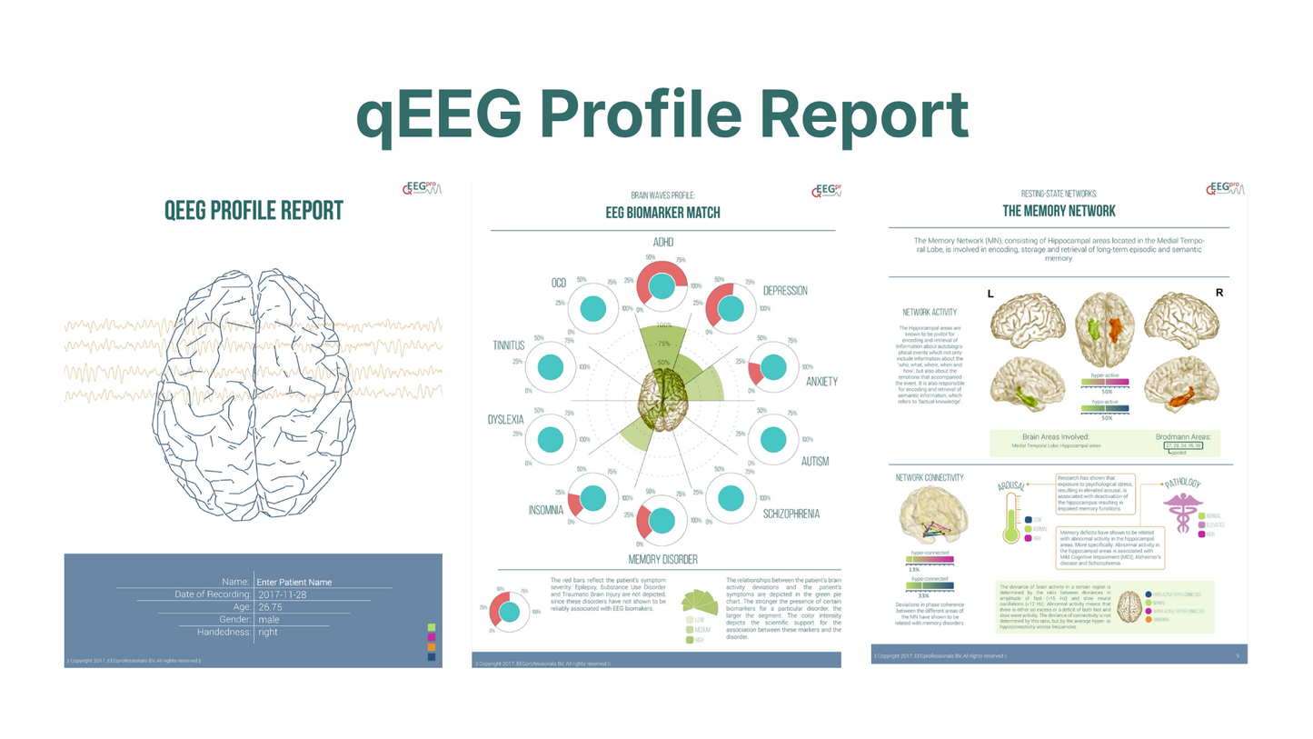 QEEG-Pro Report Service Silver (Einmalig für 1 Jahr, Jahresabo)