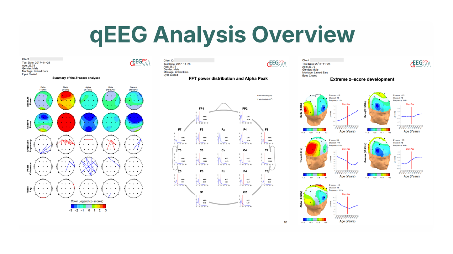 QEEG-Pro Report Service Silver (Einmalig für 1 Jahr, Jahresabo)