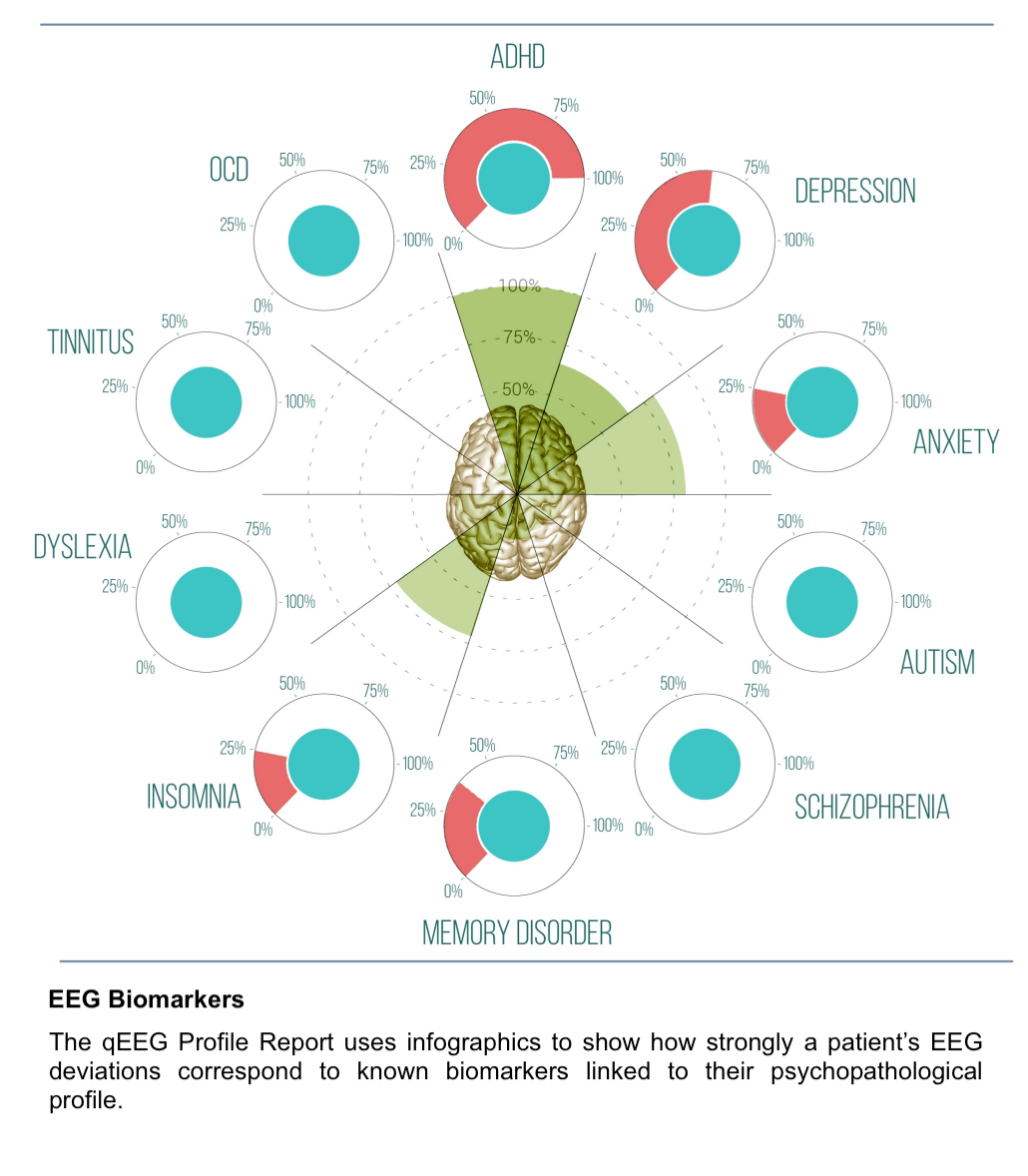 QEEG-Pro Report Service Silver (Einmalig für 1 Jahr, Jahresabo)