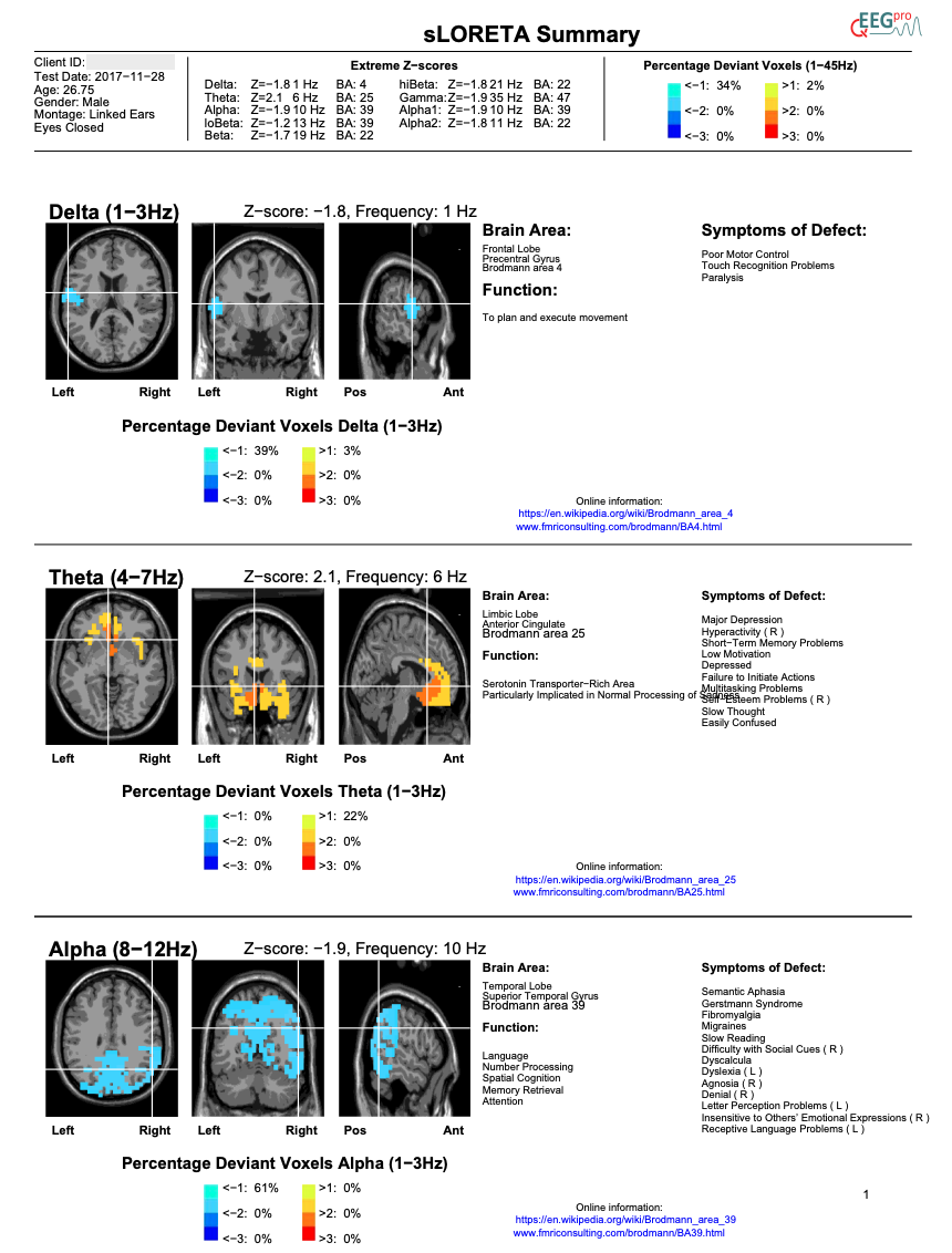 qEEG Report Service Gold