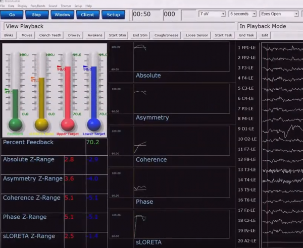 Spezielle Neurofeedback Protokolle