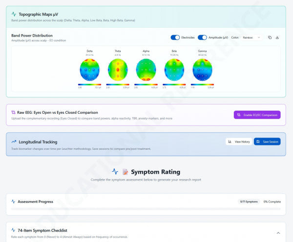 QEEG Analyse und Reports