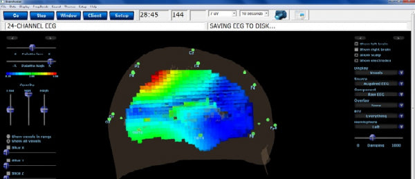 BrainAvatar ™ 4.0 Discovery Live sLORETA Projector - Neurofeedback Software