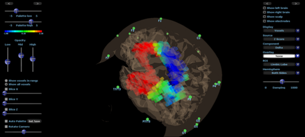 Discovery 24E EEG-Gerät 19 Kanal mit BrainAvatar 4.0 (mit integriertem Impedanzmesser)