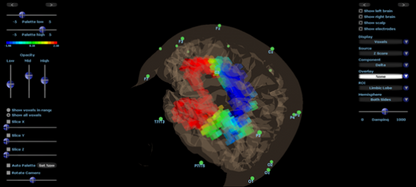Discovery 24 EEG-/QEEG-Gerät mit 19 Kanälen und BrainAvatar 4.0 Acquisition (inkl. integriertem Impedanzmesser)