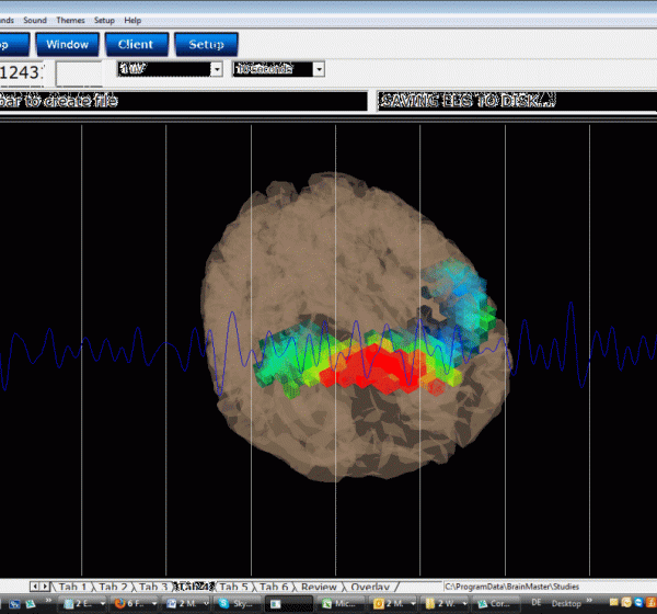 Discovery 24E EEG-Gerät 19 Kanal mit BrainAvatar 4.0 (mit integriertem Impedanzmesser)