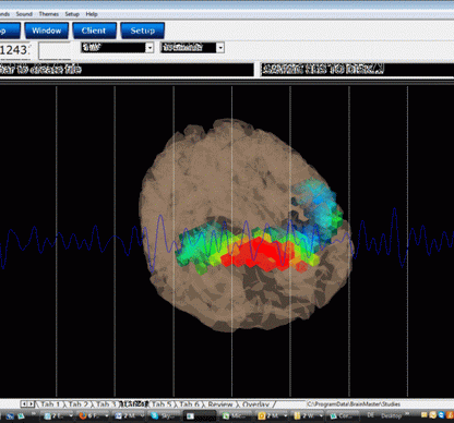 Discovery 24 EEG-/QEEG-Gerät mit 19 Kanälen und BrainAvatar 4.0 Acquisition (inkl. integriertem Impedanzmesser)