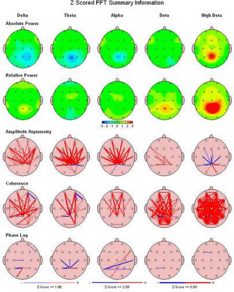 NeuroGuide QEEG-Software