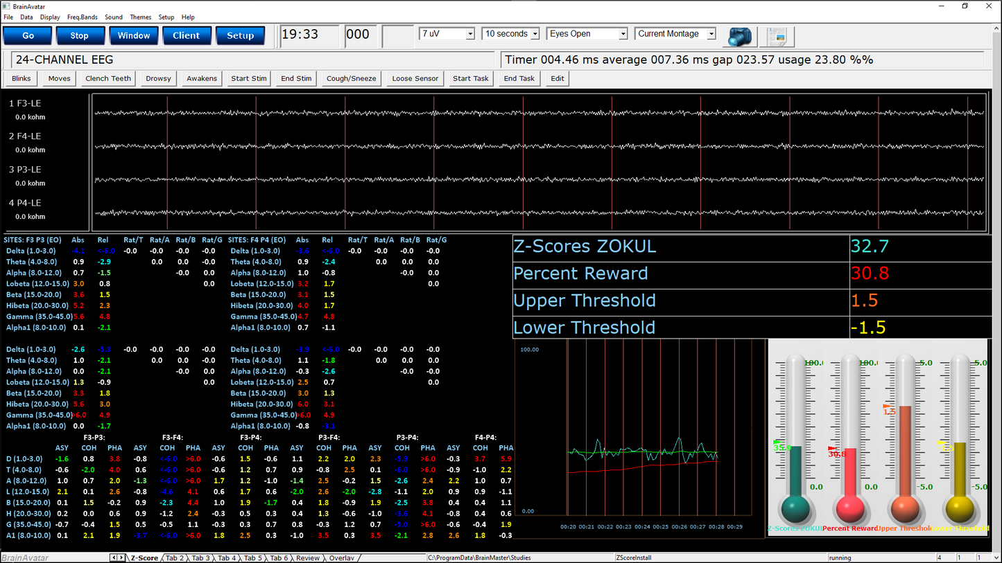 qEEG Pro 4-Kanal-Z-Score-Training