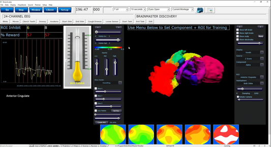 BrainAvatar ™ 4.0 Discovery Acquisition