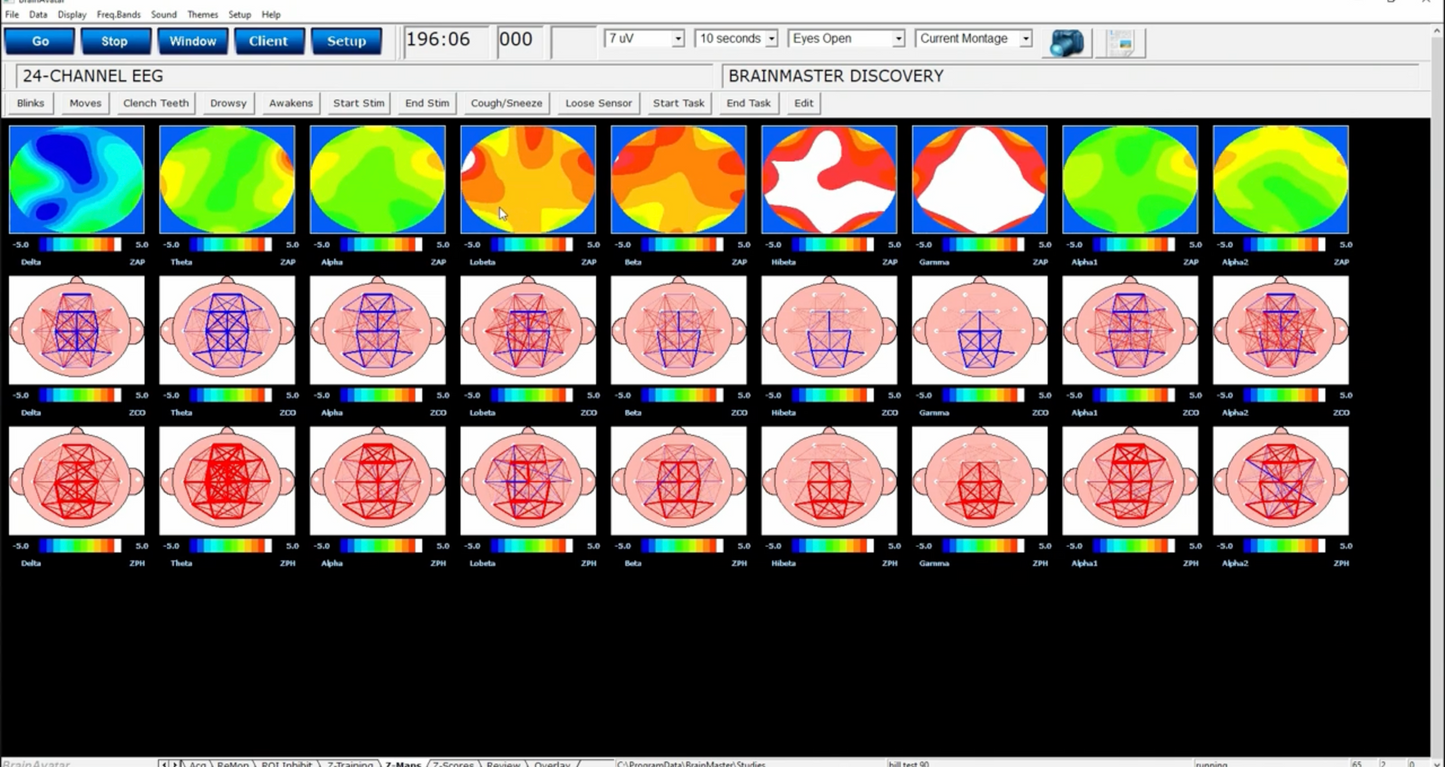 BrainAvatar ™ 4.0 Discovery Acquisition