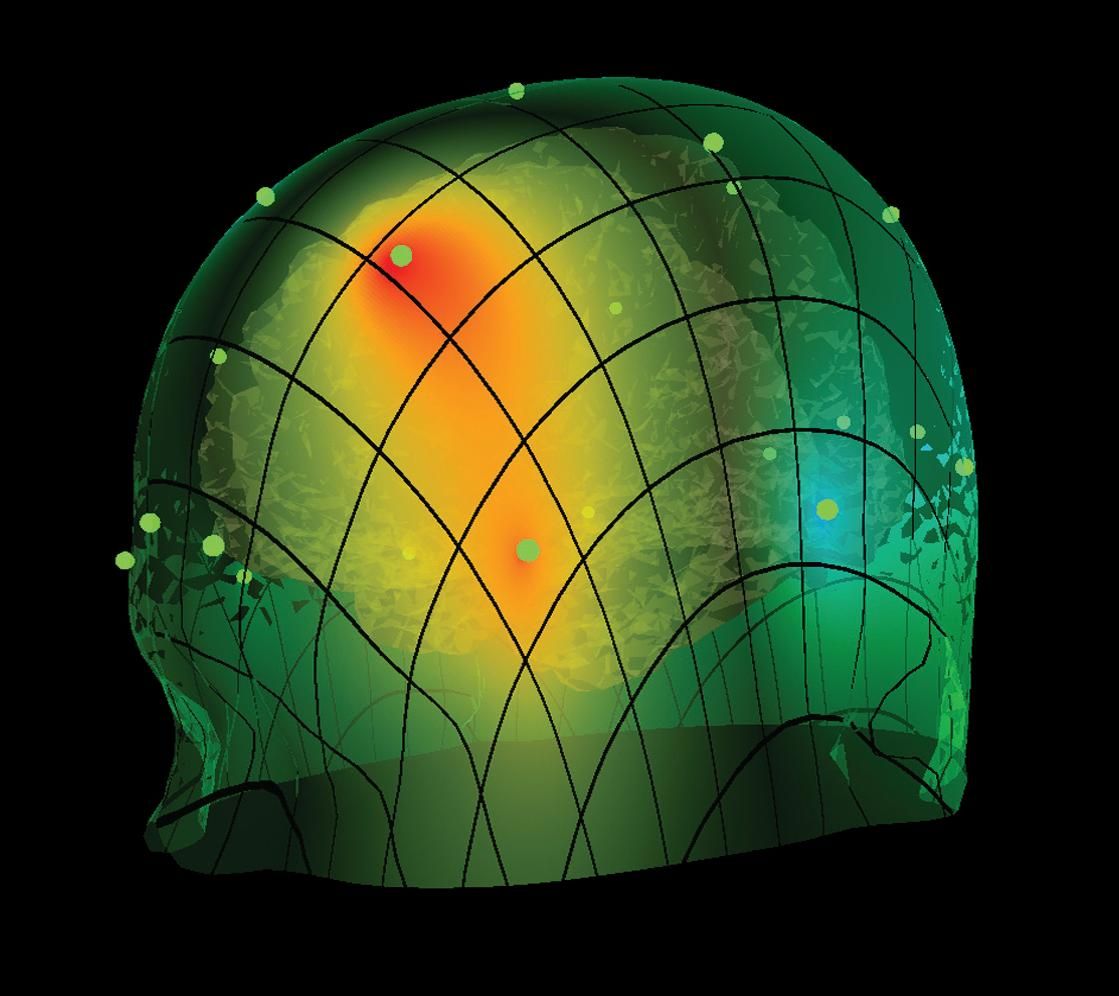 BrainAvatar ™ 4.0 Discovery Live sLORETA Projector - Neurofeedback Software