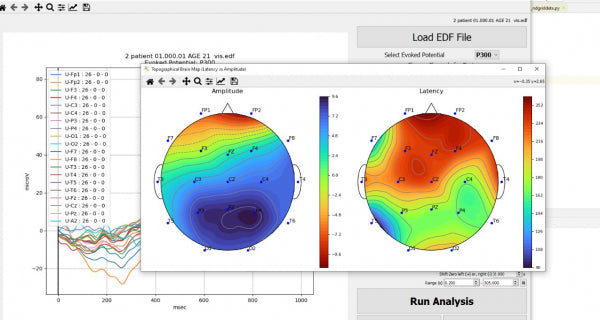 IFEN ERP-Set: Ereignis-Korrelierte Potentiale für Brainmaster Atlantis und Discovery