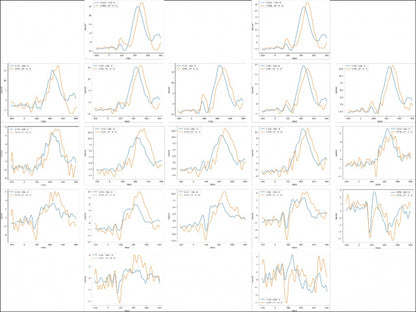 IFEN ERP-Set: Ereignis-Korrelierte Potentiale für Brainmaster Atlantis und Discovery