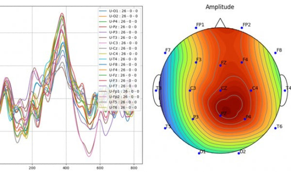 IFEN ERP-Set: Ereignis-Korrelierte Potentiale für Brainmaster Atlantis und Discovery