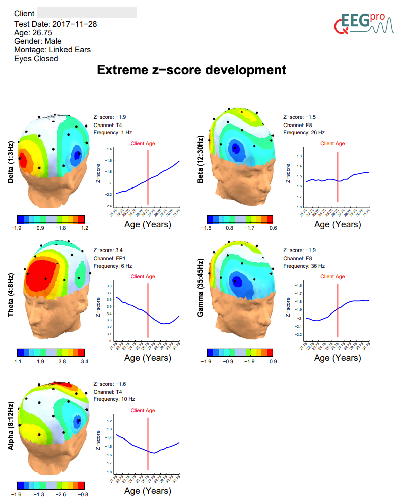 qEEG-Report-Service Bronze