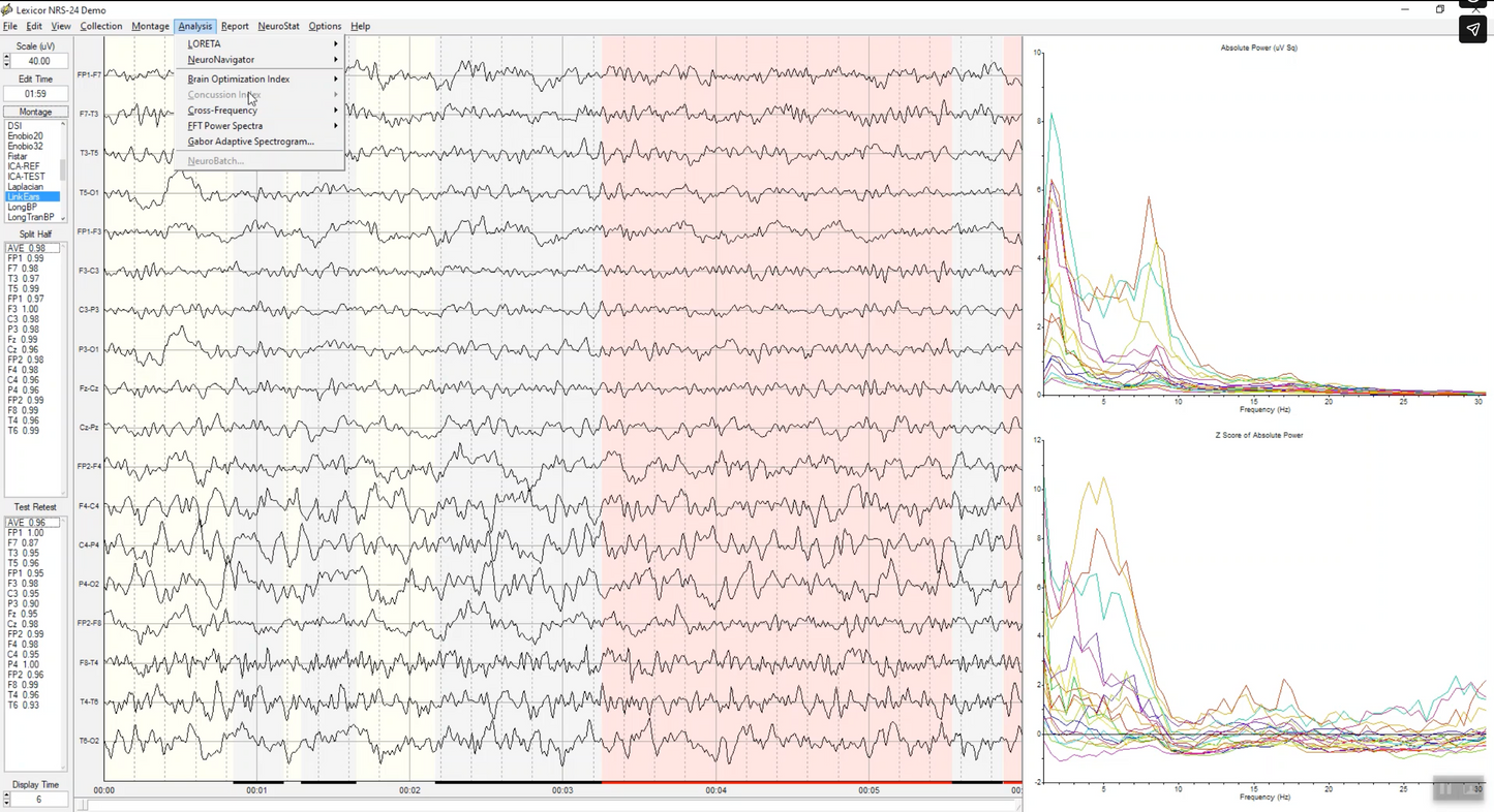 NeuroGuide | Professionelle QEEG-Analyse & Brain Mapping