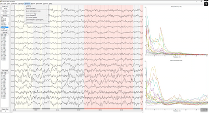 NeuroGuide | Professionelle QEEG-Analyse & Brain Mapping