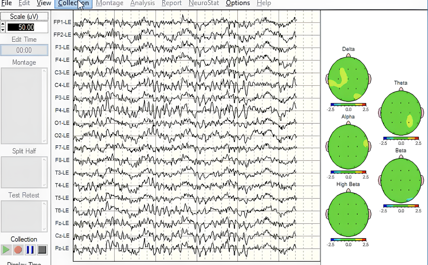 NeuroGuide | Professionelle QEEG-Analyse & Brain Mapping