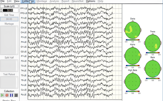 NeuroGuide | Professionelle QEEG-Analyse & Brain Mapping