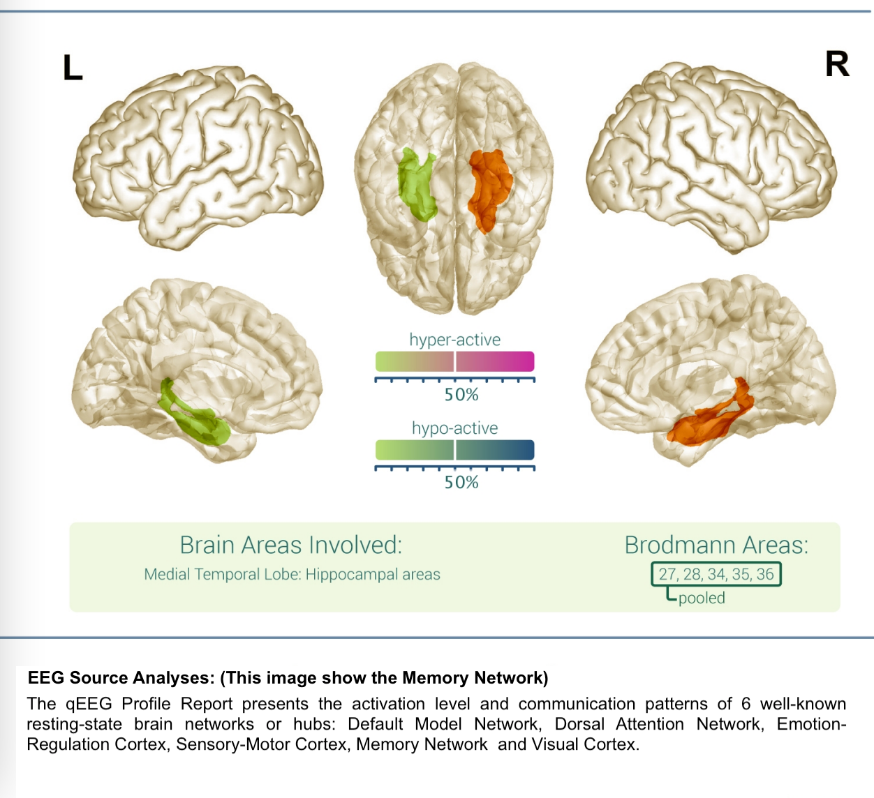 qEEG-Report-Service Bronze