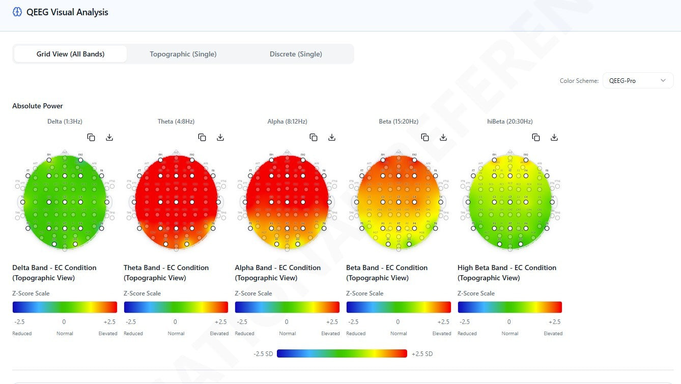 IFEN Neuropathfinder: Ihr QEEG-Assistent