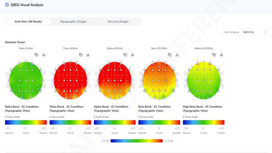 IFEN Neuropathfinder: Ihr QEEG-Assistent
