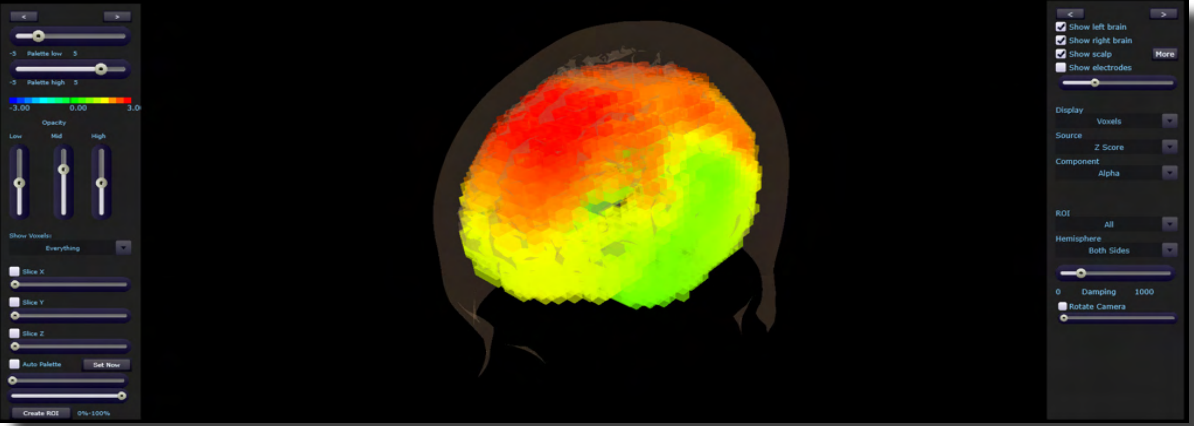 BrainAvatar 4.0 LLP Connectivity Suite