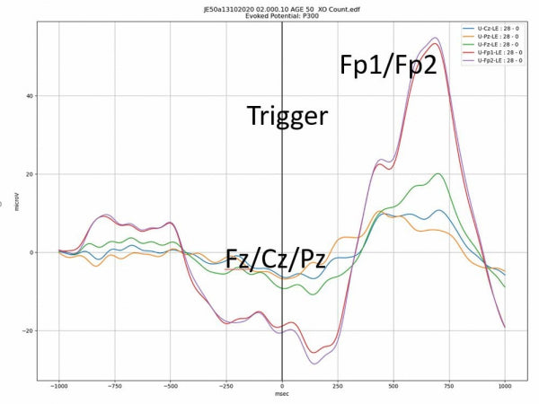 IFEN ERP-Set: Ereignis-Korrelierte Potentiale für Brainmaster Atlantis und Discovery