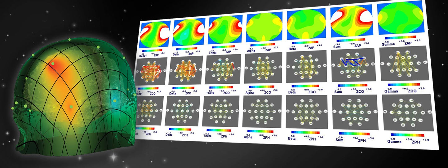 Discovery 24E EEG-Gerät 19 Kanal mit BrainAvatar 4.0 (mit integriertem Impedanzmesser)