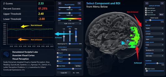 qEEGPRO Surface/sLORETA Z-Score Combination - Set