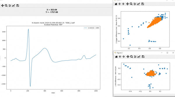 IFEN ERP-Set: Ereignis-Korrelierte Potentiale für Brainmaster Atlantis und Discovery