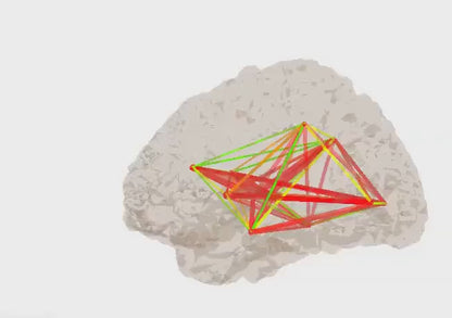 Discovery 24 EEG-/QEEG-Gerät mit 19 Kanälen und BrainAvatar 4.0 Acquisition (inkl. integriertem Impedanzmesser)